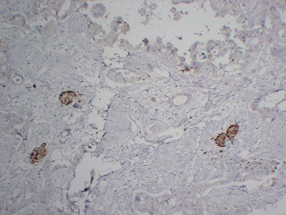 Anti-Chromogranin A Mouse Monoclonal Antibody