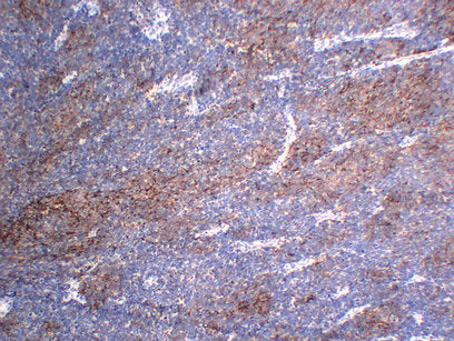 Anti-Chromogranin A Mouse Monoclonal Antibody