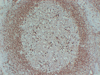 Anti-CD79a Mouse Monoclonal Antibody