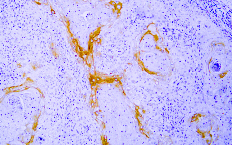 Anti-Cytokeratin 10 Mouse Monoclonal Antibody