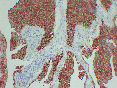 Anti-Cytokeratin 13 Mouse Monoclonal Antibody