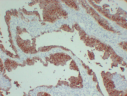 Anti-Cytokeratin 13 Mouse Monoclonal Antibody