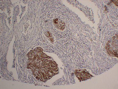 Anti-Cytokeratin 5 Mouse Monoclonal Antibody