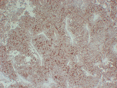 Anti-CD99 Mouse Monoclonal Antibody