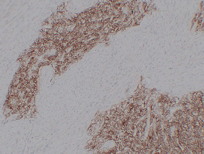 Anti-CD99 Mouse Monoclonal Antibody