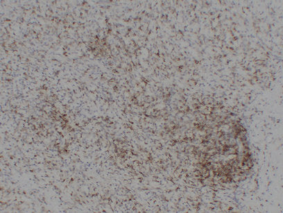 Anti-CD43 Mouse Monoclonal Antibody