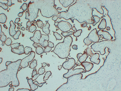 Anti-CD105 Mouse Monoclonal Antibody