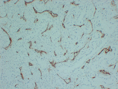 Anti-CD105 Mouse Monoclonal Antibody