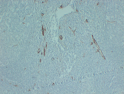 Anti-CD105 Mouse Monoclonal Antibody
