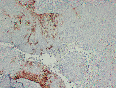 Anti-Cytokeratin 15 Mouse Monoclonal Antibody