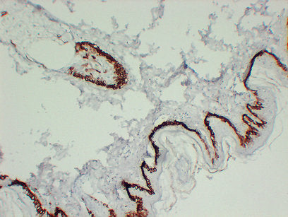 Anti-Cytokeratin 15 Mouse Monoclonal Antibody
