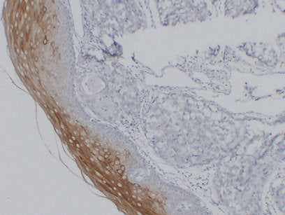 Anti-Cytokeratin 4 Mouse Monoclonal Antibody