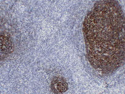 Anti-CD21 Mouse Monoclonal Antibody