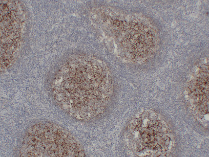 Anti-CD21 Mouse Monoclonal Antibody