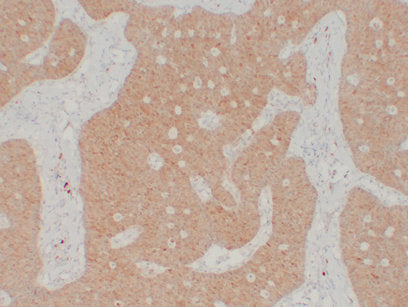Anti-Calretinin Mouse Monoclonal Antibody