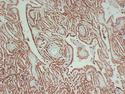 Anti-Calretinin Mouse Monoclonal Antibody