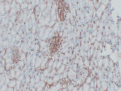 Anti-CD34 Mouse Monoclonal Antibody