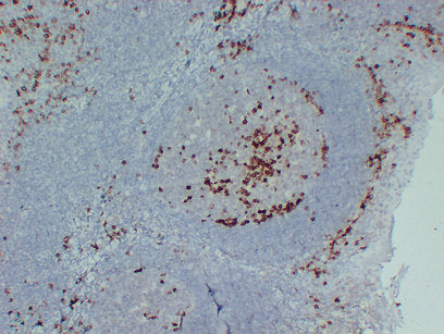 Anti-CD38 Mouse Monoclonal Antibody