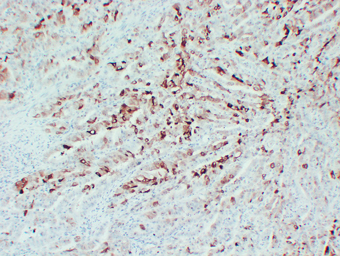 Anti-Cyclooxygenase 2 Mouse Monoclonal Antibody