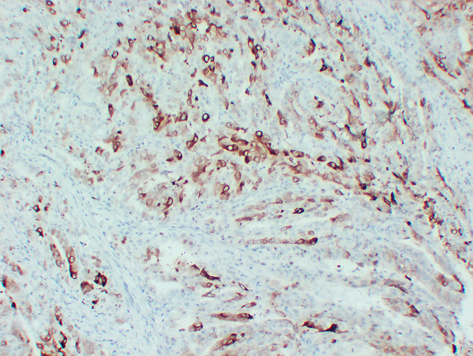 Anti-Cyclooxygenase 2 Mouse Monoclonal Antibody