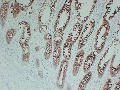 Anti-Cytokeratin 20 Mouse Monoclonal Antibody