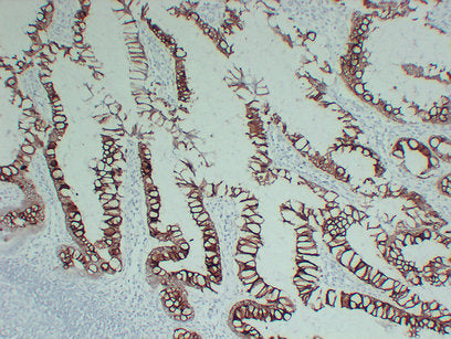 Anti-Cytokeratin 20 Mouse Monoclonal Antibody