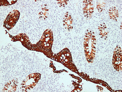 Anti-Cytokeratin 20 Mouse Monoclonal Antibody