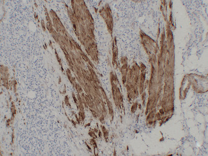 Anti-Calponin 1 Mouse Monoclonal Antibody