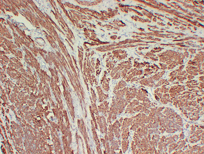Anti-Calponin 1 Mouse Monoclonal Antibody