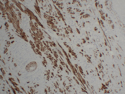Anti-Calponin 1 Mouse Monoclonal Antibody