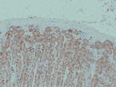 Anti-Claudin 18 Mouse Monoclonal Antibody