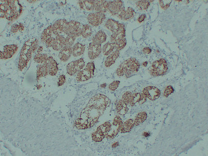Anti-Claudin 18 Mouse Monoclonal Antibody