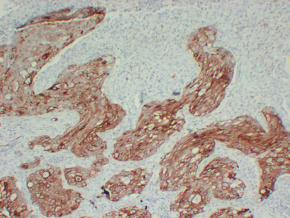 Anti-Cytokeratin 17 Mouse Monoclonal Antibody