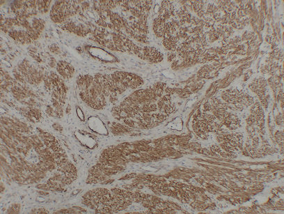 Anti-Caldesmon Mouse Monoclonal Antibody