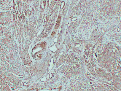 Anti-Caldesmon Mouse Monoclonal Antibody