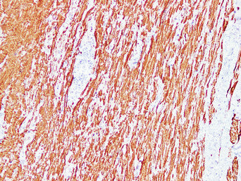 Anti-Desmin Mouse Monoclonal Antibody