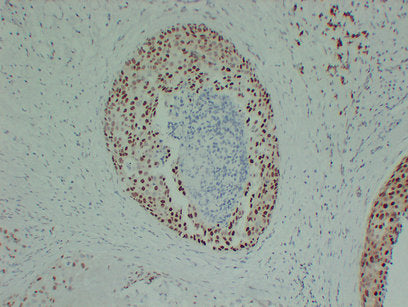 Anti-Estrogen Receptor alpha Mouse Monoclonal Antibody
