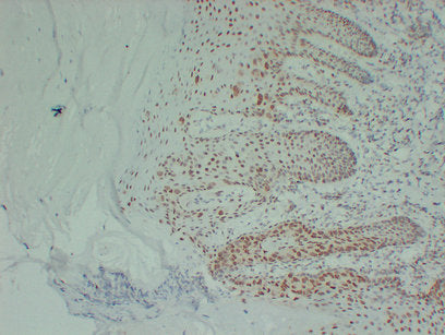 Anti-Estrogen Receptor alpha Mouse Monoclonal Antibody