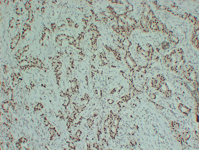 Anti-Estrogen Receptor alpha Mouse Monoclonal Antibody