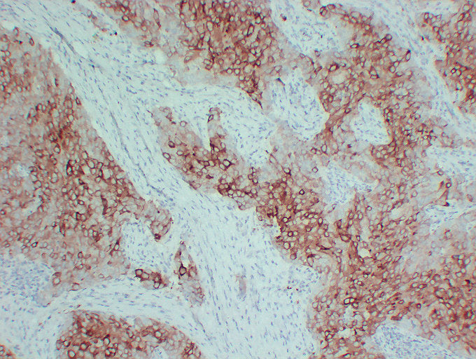 Anti-Estrogen Inducible Protein pS2 Mouse Monoclonal Antibody