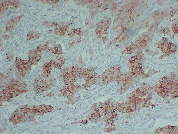 Anti-Estrogen Inducible Protein pS2 Mouse Monoclonal Antibody