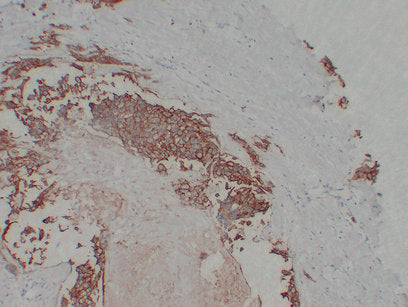 Anti-ErbB 2 Mouse Monoclonal Antibody
