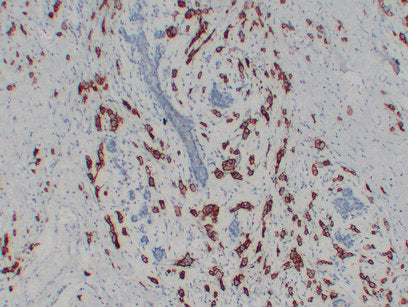Anti-ErbB 2 Mouse Monoclonal Antibody