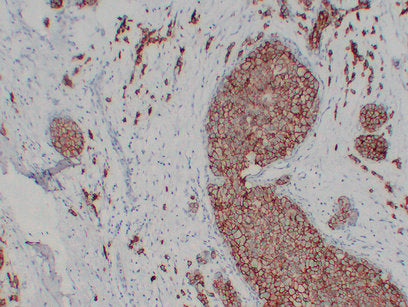 Anti-ErbB 2 Mouse Monoclonal Antibody