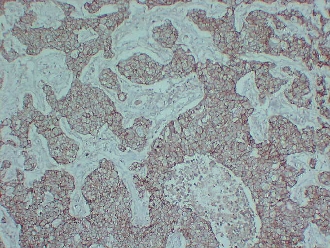 Anti-E Cadherin Mouse Monoclonal Antibody
