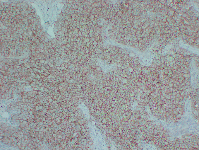 Anti-E Cadherin Mouse Monoclonal Antibody