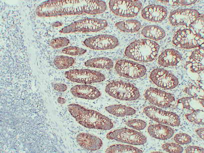 Anti-EpCAM Mouse Monoclonal Antibody