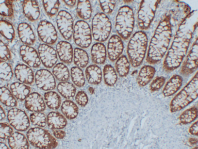 Anti-EpCAM Mouse Monoclonal Antibody