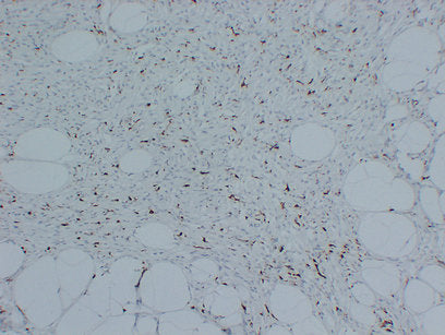 Anti-Factor XIIIa Mouse Monoclonal Antibody