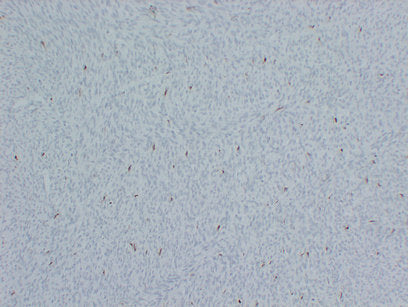 Anti-Factor XIIIa Mouse Monoclonal Antibody